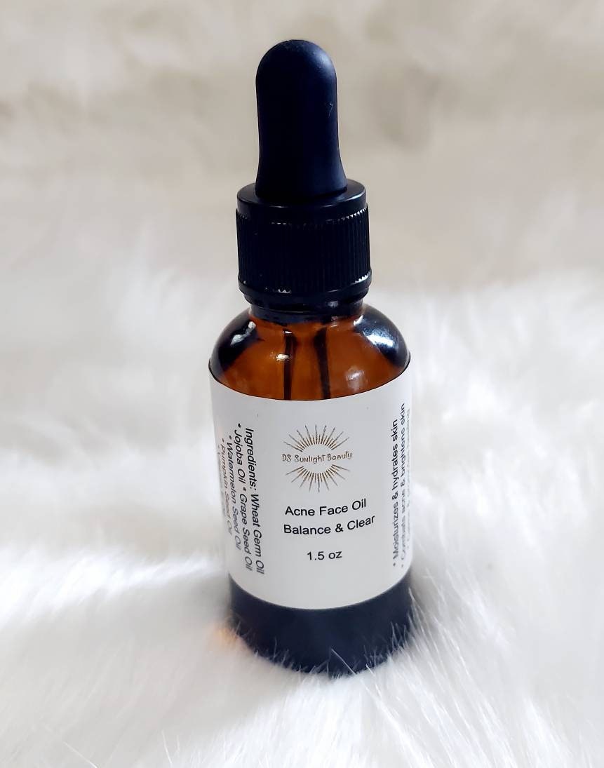 Acne facial oil Etsy