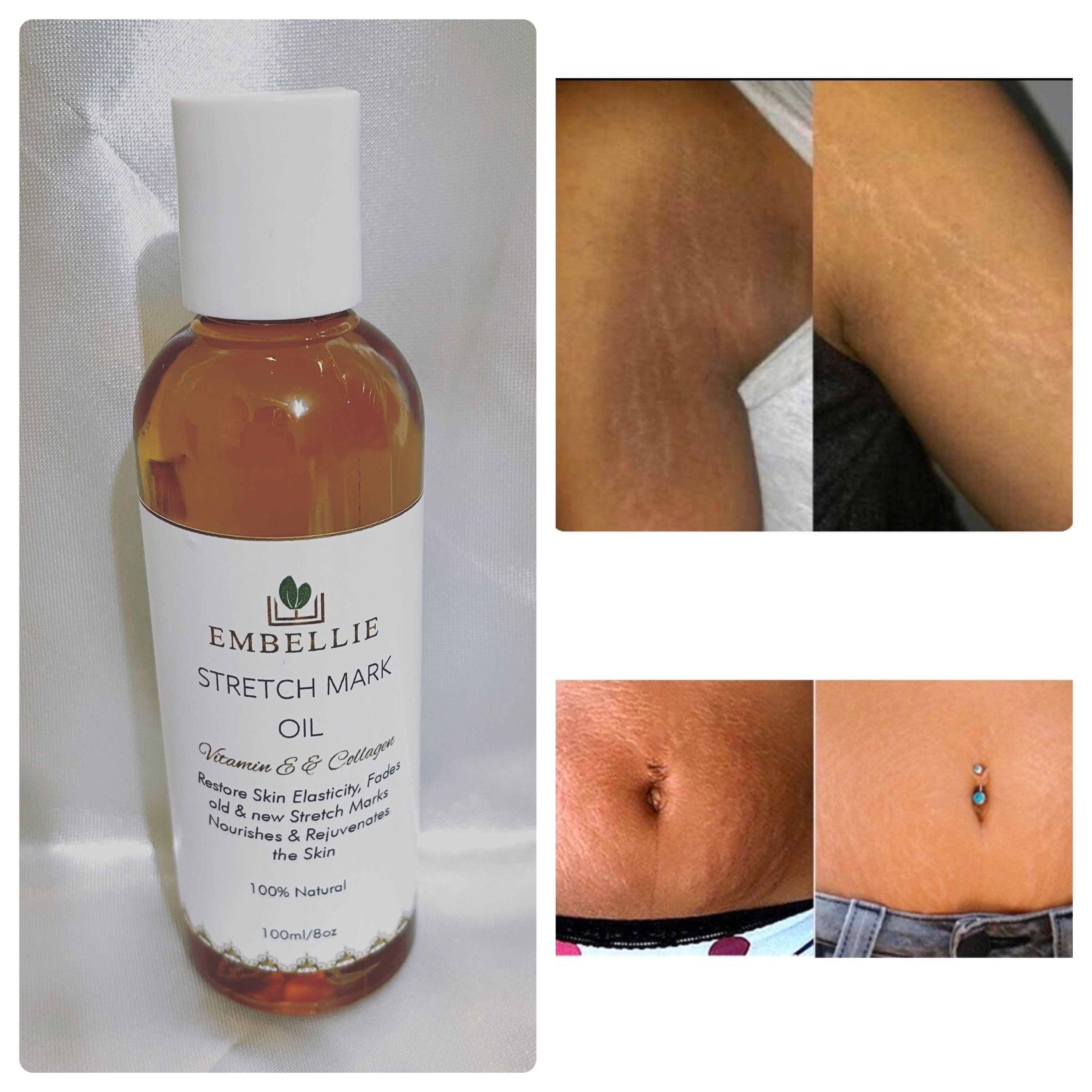 Stretch Mark Oil With Vitamin E & Collagen Skin Firming Oil Etsy UK