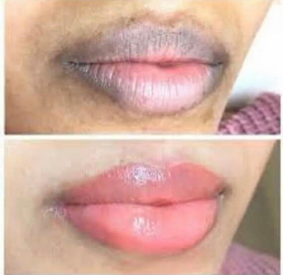 EXTREME Pink Lip Brightening Scrub Solution Dark Lip Etsy