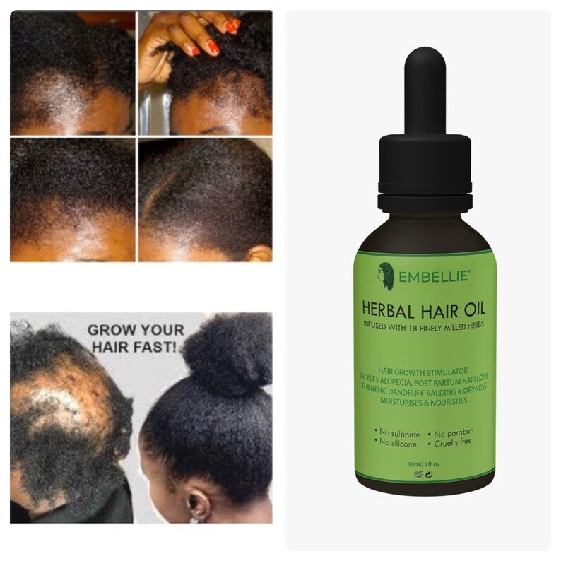 Herbal Hair Growth Oil With Chebe Alopecia Promotes Hair Etsy UK