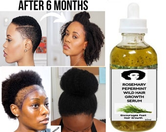 Rosemary Hair Growth Serum, Fast Hair Growth Serum,  Thick Hair Growth, Long Hair