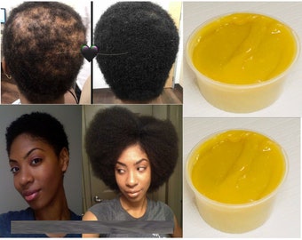 Super Growth Hair Grease, Grow Your Edges,Hair Growth, Thick Hair