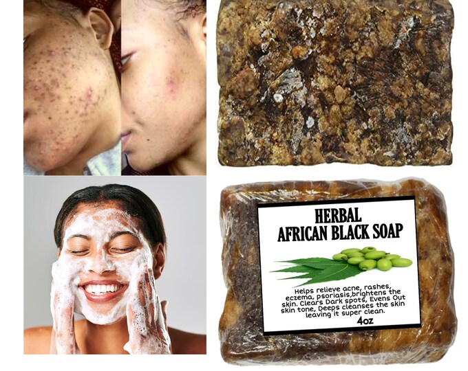 African Black Soap Herbal Black Soap Neem Soap Acne Soap Etsy