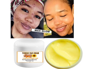 Tumeric face cream, spots remover,  glowing skin, brighter skin, even skin tone