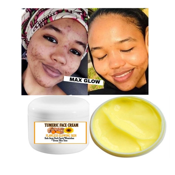 Tumeric face cream, spots remover,  glowing skin, brighter skin, even skin tone