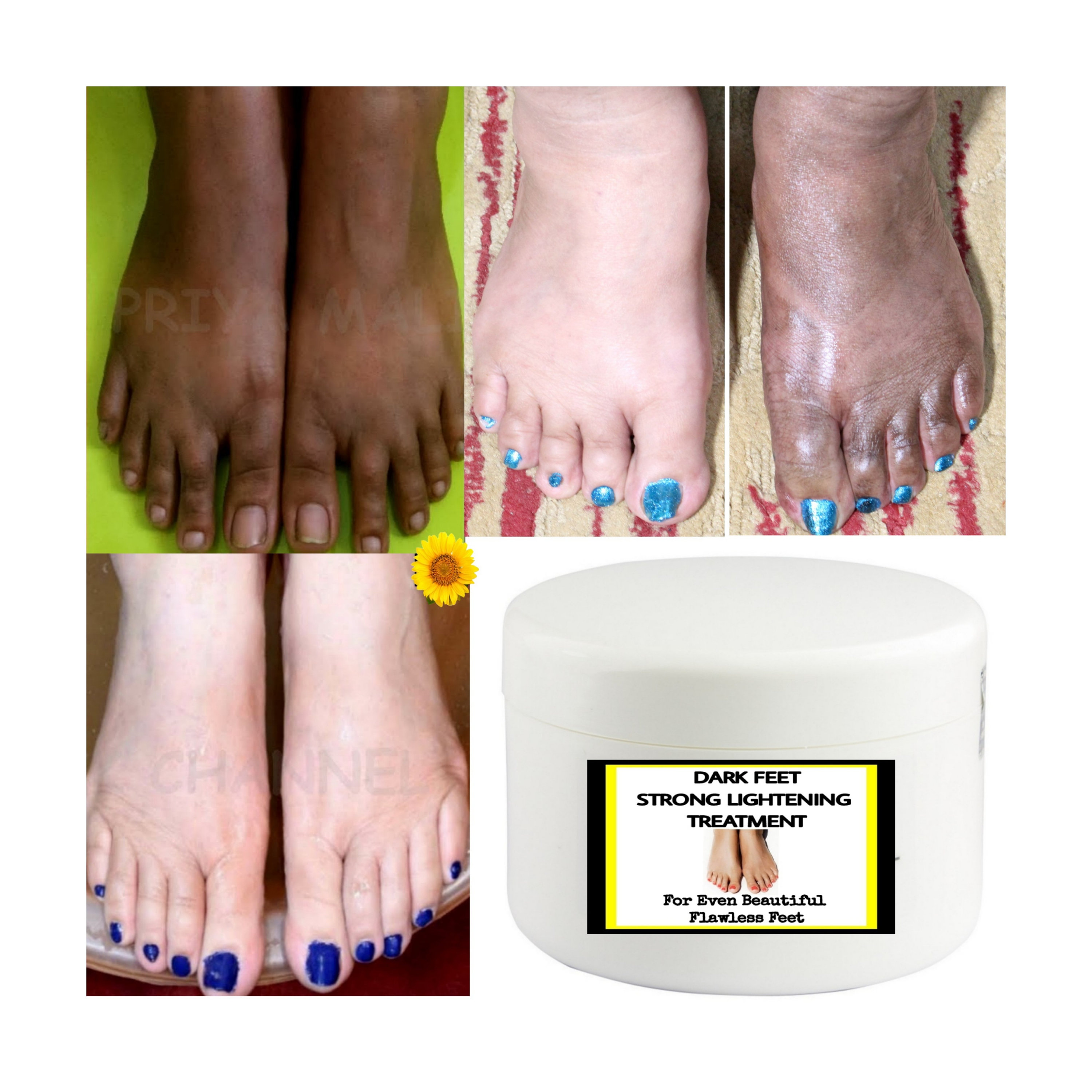 Dark Feet Strong Lightening Cream Fast Action Etsy