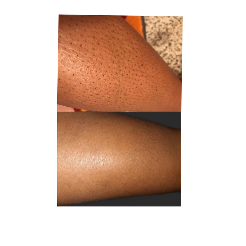 Strawberry Legs Exfoliating Cream Potent Formula Etsy