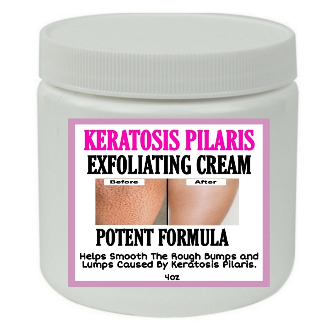 Strawberry Legs Exfoliating Cream Potent Formula Etsy UK