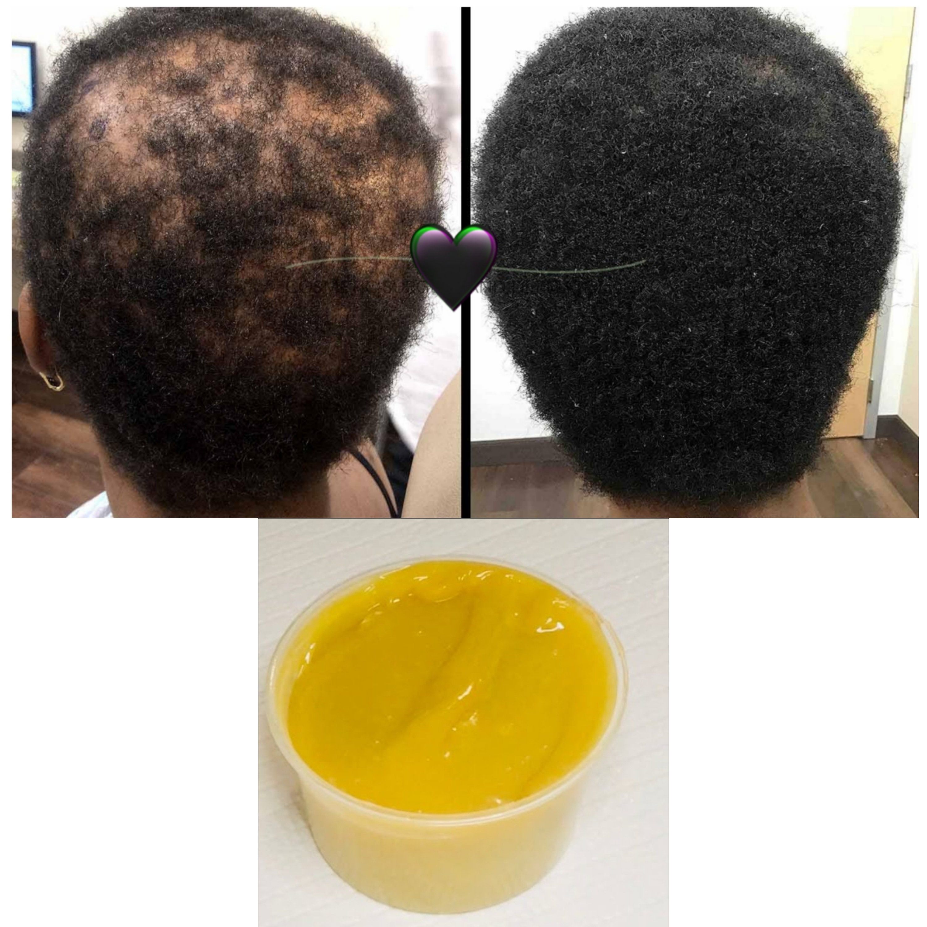 Super Growth Hair Grease Grow Your Edgeshair Growth Thick Etsy UK