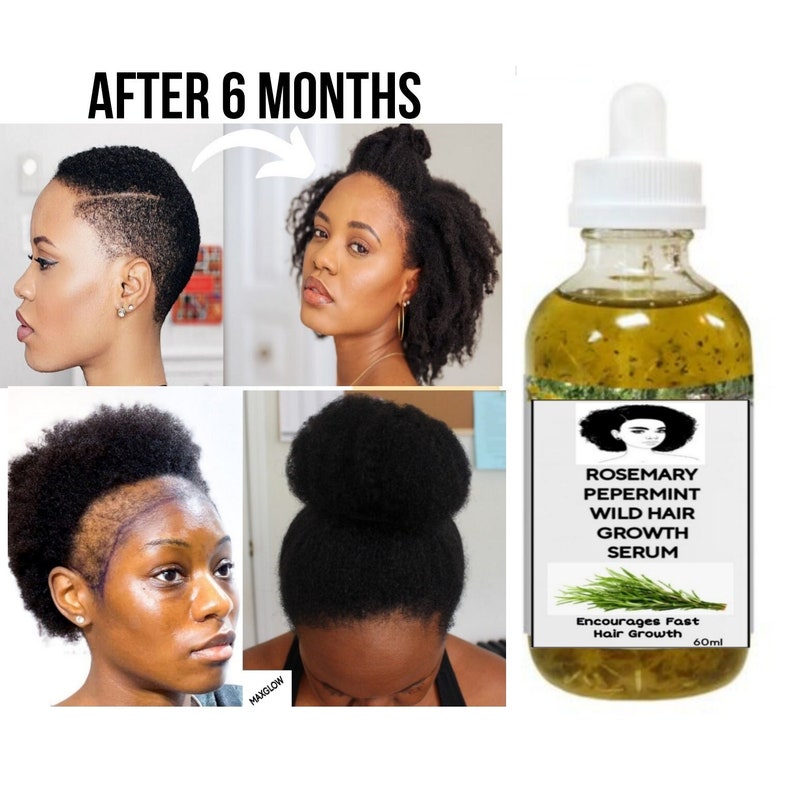 Rosemary Hair Growth Serum Fast Hair Growth Serum Thick Hair Etsy