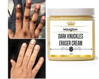 Dark knuckles Eraser cream, Clean Knuckles,  Beautiful Hands