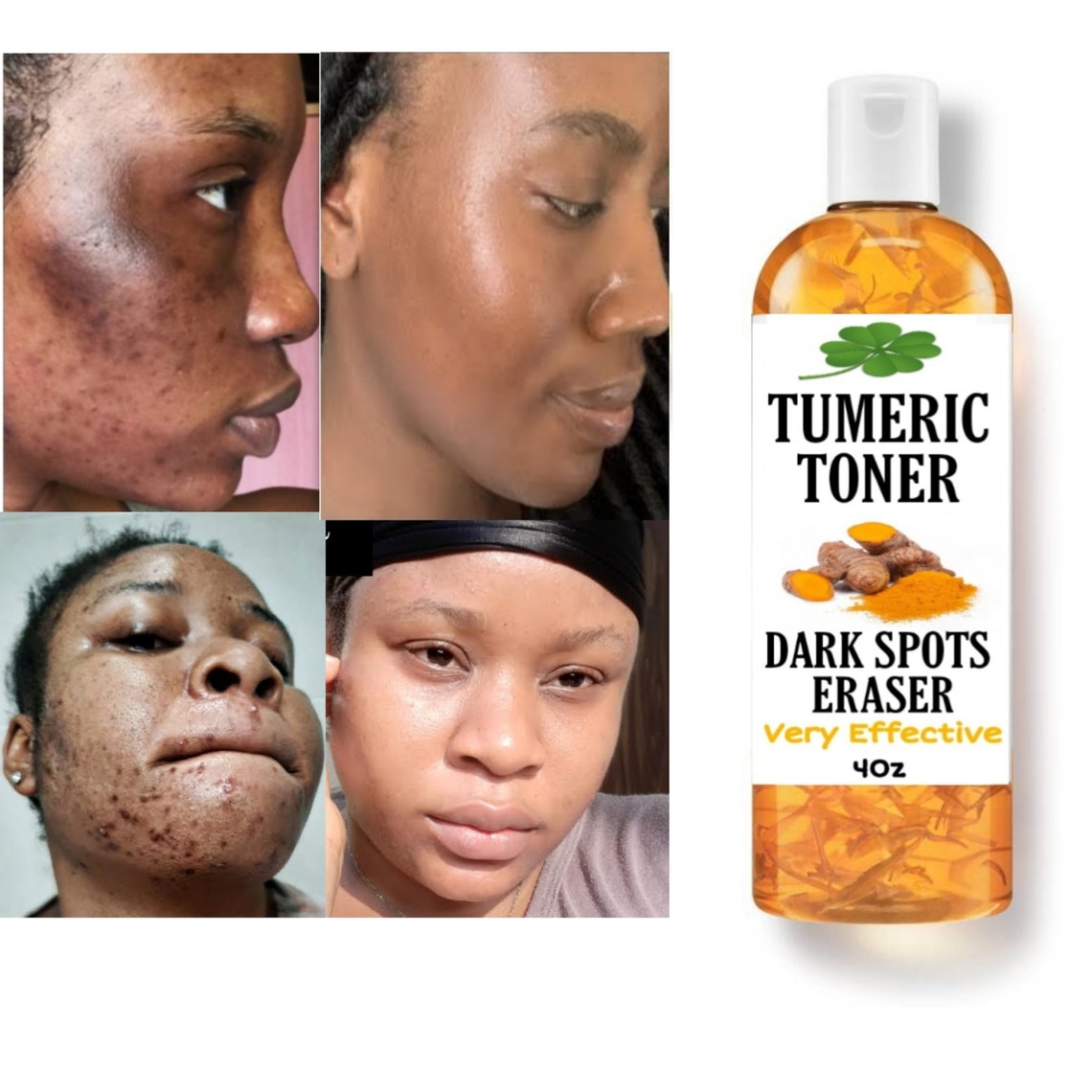 Tumeric Dark Spots Toner Dark Spots Eraser Even Skin Tone Etsy
