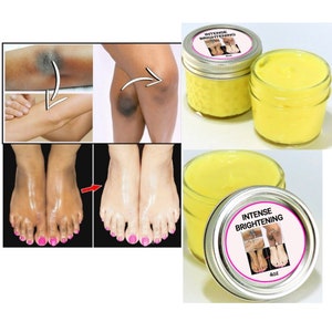 INTENSE BRIGHTENING, Knee, Feet, Elbows Cream, Very Effective, It Works image 1