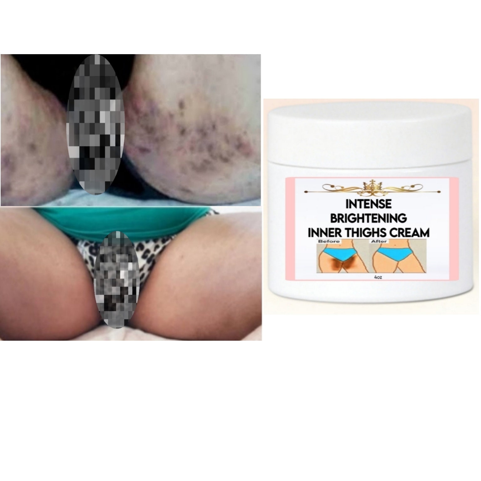 Best Product For Dark Inner Thighs - Temu