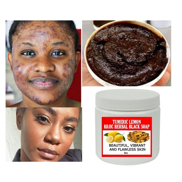 Tumeric Kojic Black soap, Herbal black soap, Spots Free Skin, Even Skin ,Smooth skin, Glowing Skin