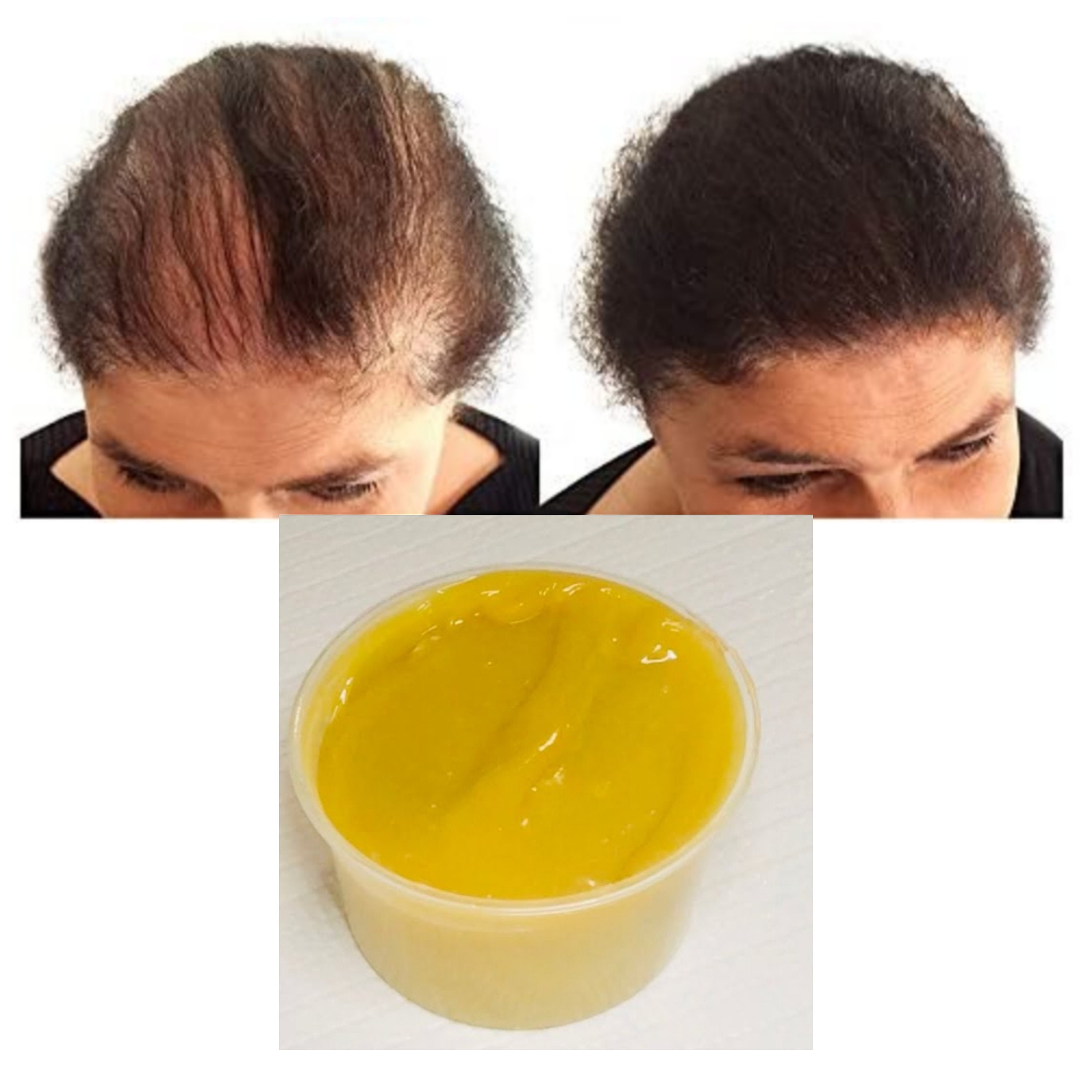 Super Growth Hair Grease Grow Your Edgeshair Growth Thick Etsy UK