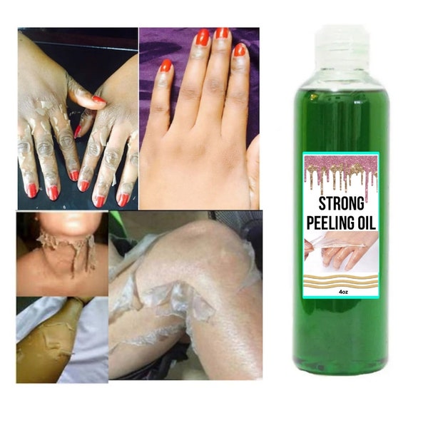 Peeling oil, Strong peeling oil, Extra strength