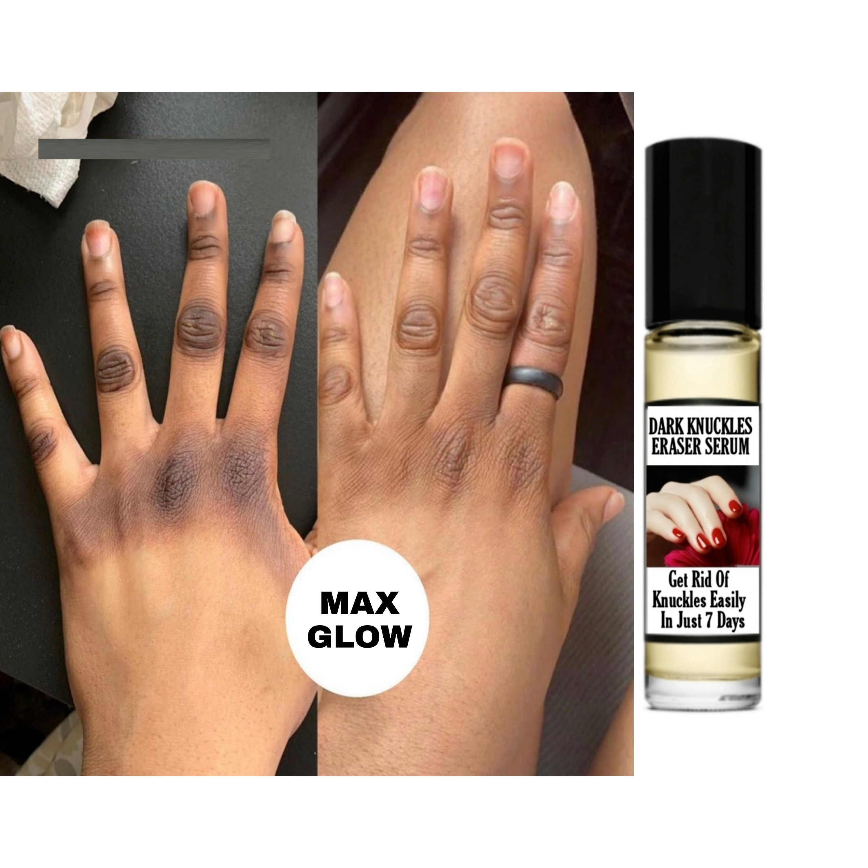 Buy Clear All Dark Knuckles Clear And Dark Spot Remover Carrot