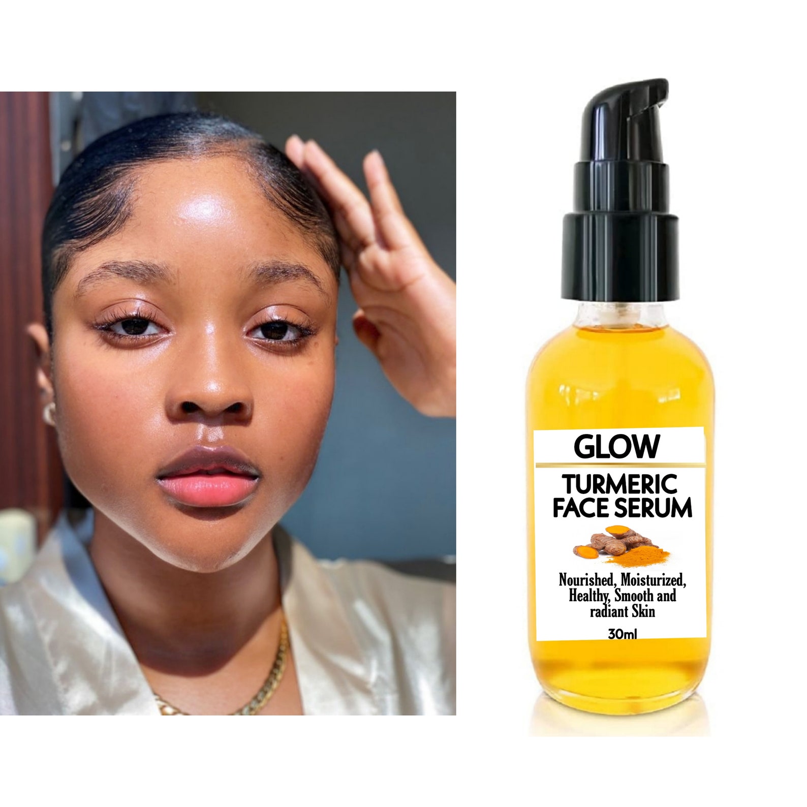 Turmeric Serum Dark Spots Eraser Spotless Skin Etsy
