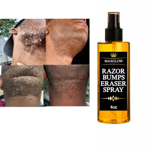 Spray tapón Razor Bumps, Barba, Cabeza, Zona del bikini