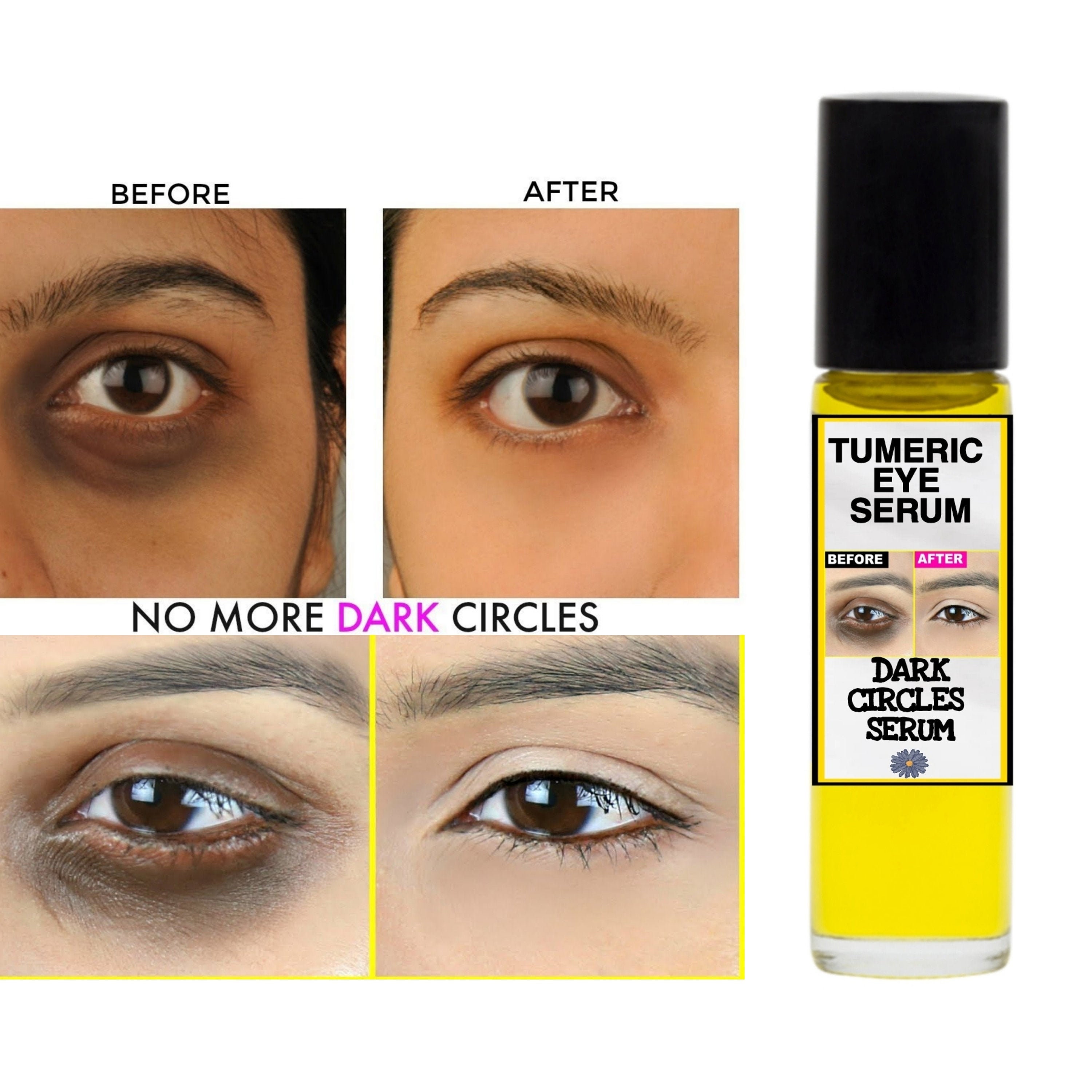 Dark circles, undereye lightening serum, tumeric lightening serum, da…