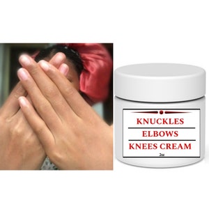May include: White jar with a red label that reads "Knuckles Elbows Knees Cream 2oz".