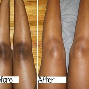 INTENSE BRIGHTENING, Knee, Feet, Elbows Cream, Very Effective, It Works image 2