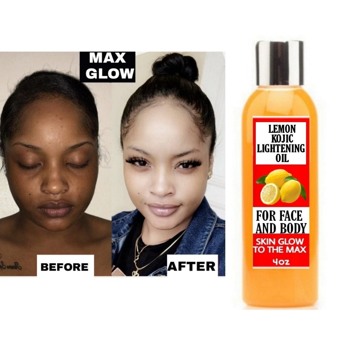 Kojic Lightening Oil Vitamin C lightening oil Kojic Etsy