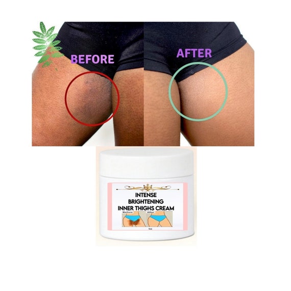 Dark inner thighs from chafing is no fun. This is how I recommend ligh, brightening deodorant