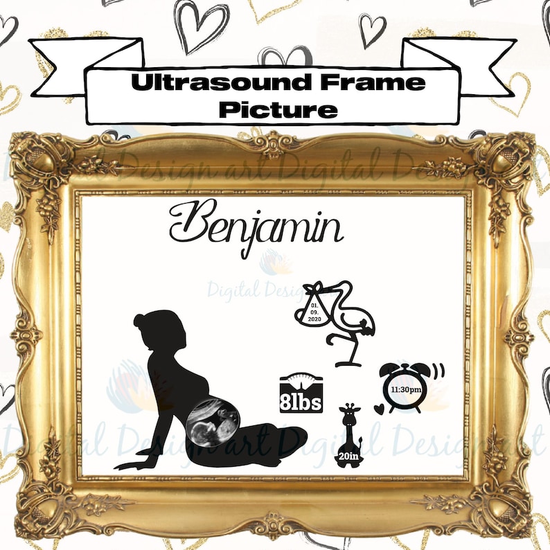 Free Free 347 Baby Ultrasound Svg SVG PNG EPS DXF File
