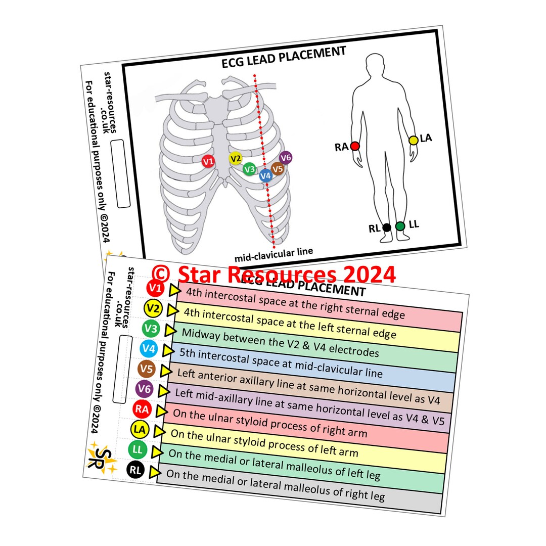 ECG Lead Placement ID Badge Flash Cards Student Paramedics Ambulance - Etsy