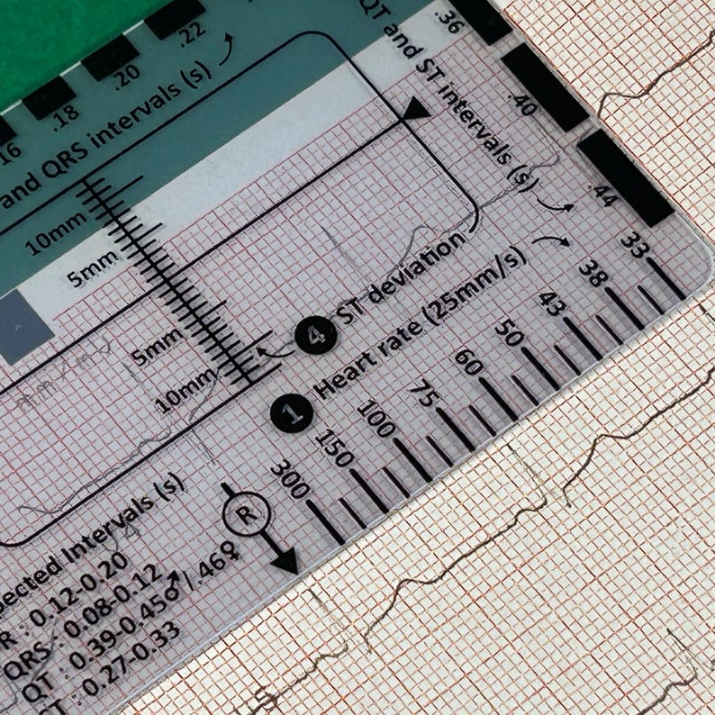 May include: A clear plastic ruler with black markings for measuring heart rate and ST deviation on an electrocardiogram (ECG). The ruler has numbers from 30 to 300, 75 to 100, and 150. The ruler also has markings for QRS and ST intervals in seconds.