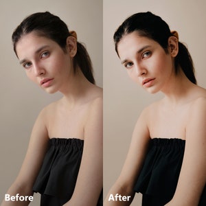 Op de afbeelding: Een voor-en-na foto van een persoon met een zwarte strapless top. De foto links toont de huid van de persoon met vlekken en roodheid. De foto rechts toont de huid van de persoon met een meer egale teint en minder roodheid.
