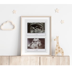 Baby Scan Print | Ultrasound Keepsake Print | 12 & 20 Week Baby Scan Print | Sonogram Print | Gift for Pregnant Mum | Mother's Day Gift Idea