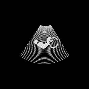 Op de afbeelding: Een witte echografie van een foetus in de baarmoeder, afgebeeld in een waaierpatroon van horizontale lijnen. De afbeelding staat tegen een zwarte achtergrond, wat een minimalistische esthetiek met hoog contrast creëert.