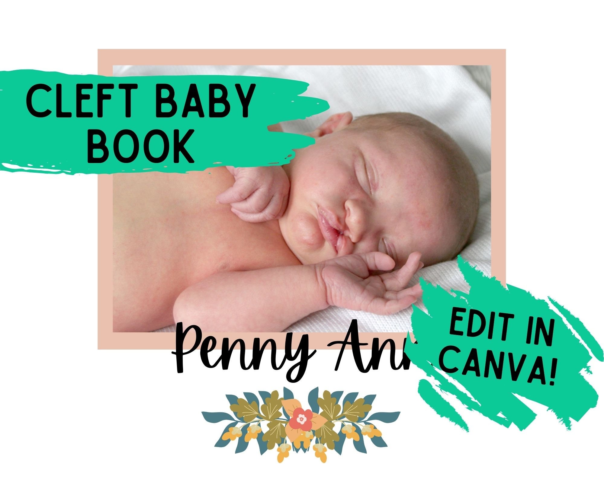 Cleft Baby Book Digital Template DIY Customize and Print With Canva