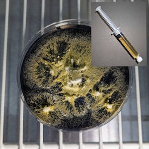 May include: A petri dish with a black and yellow mold growth. A syringe filled with a yellow liquid is shown in the upper right corner of the image.