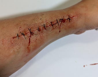 Medium size prosthetic stiches