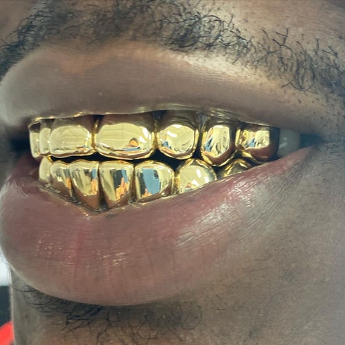 10K REAL GOLD GRILLZ florida Perm Cut Pullouts - Etsy