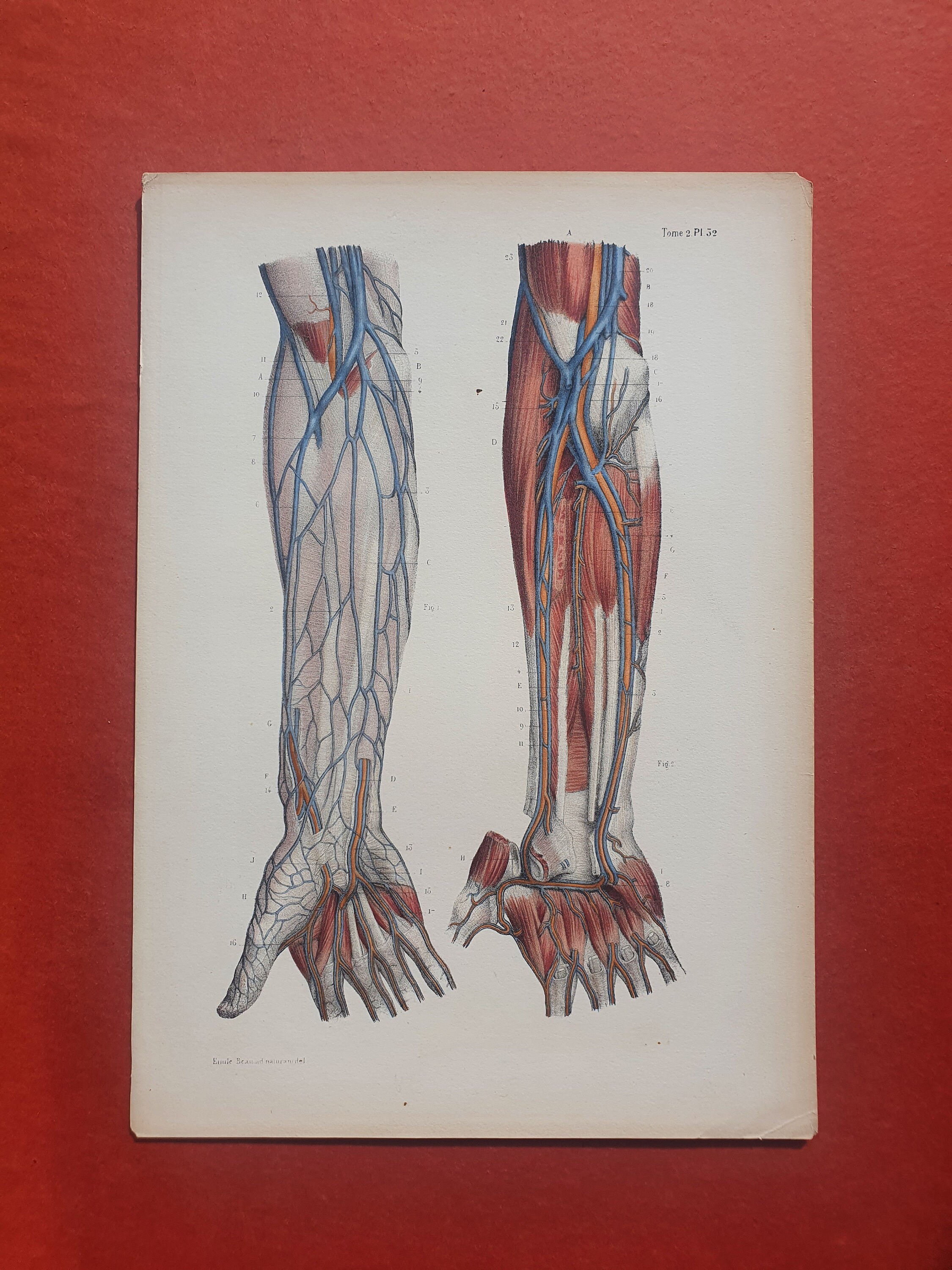 1866 年カラー リトグラフ - 解剖学 - 腕と手の静脈 2 - ボナミー C