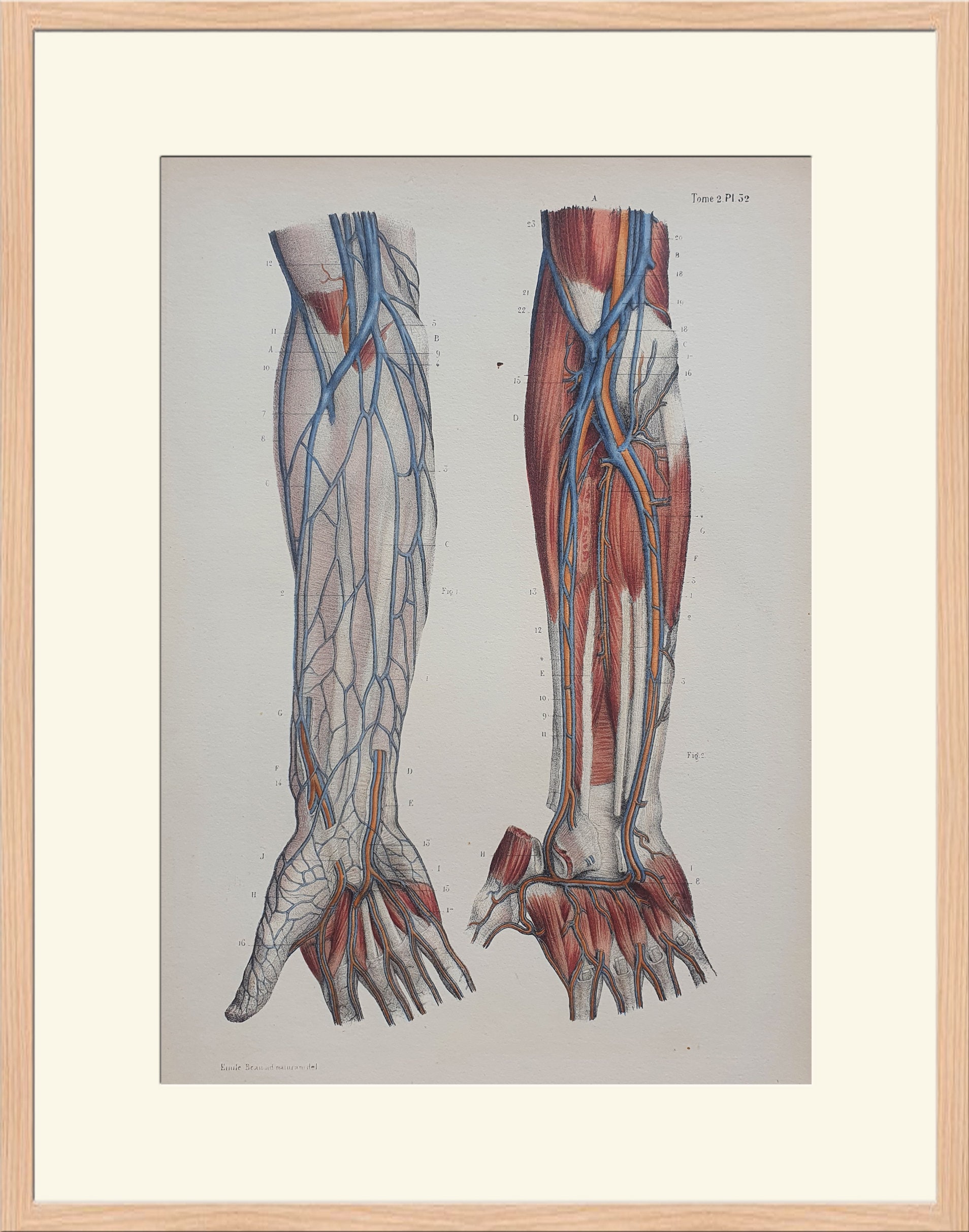 1866 年カラー リトグラフ - 解剖学 - 腕と手の静脈 2 - ボナミー C