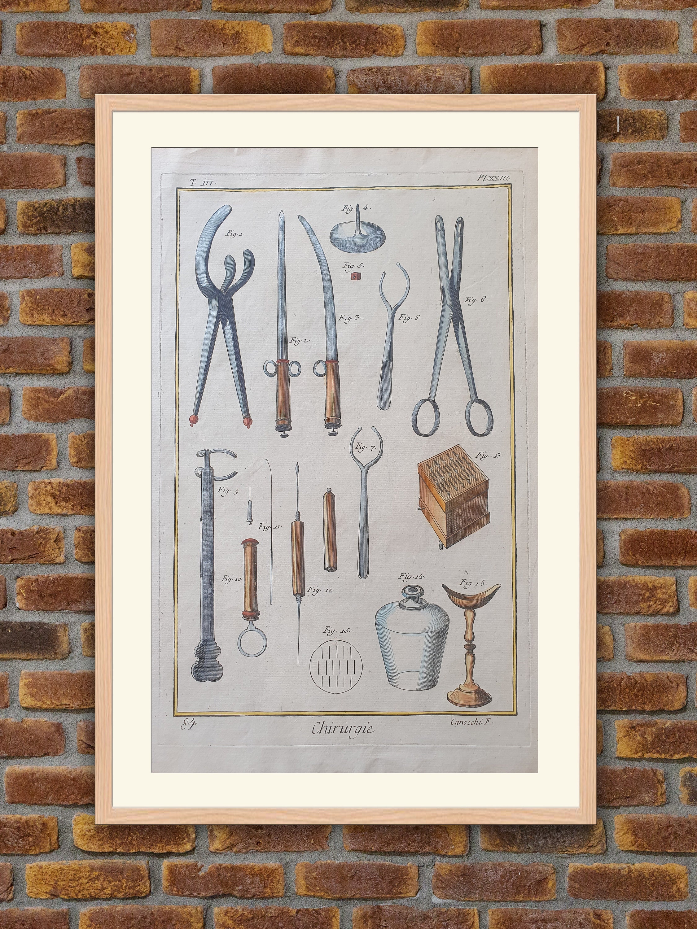 Medecine - Chirurgie Encyclopédie Diderot d'alembert 1750 Gravure Couleurs