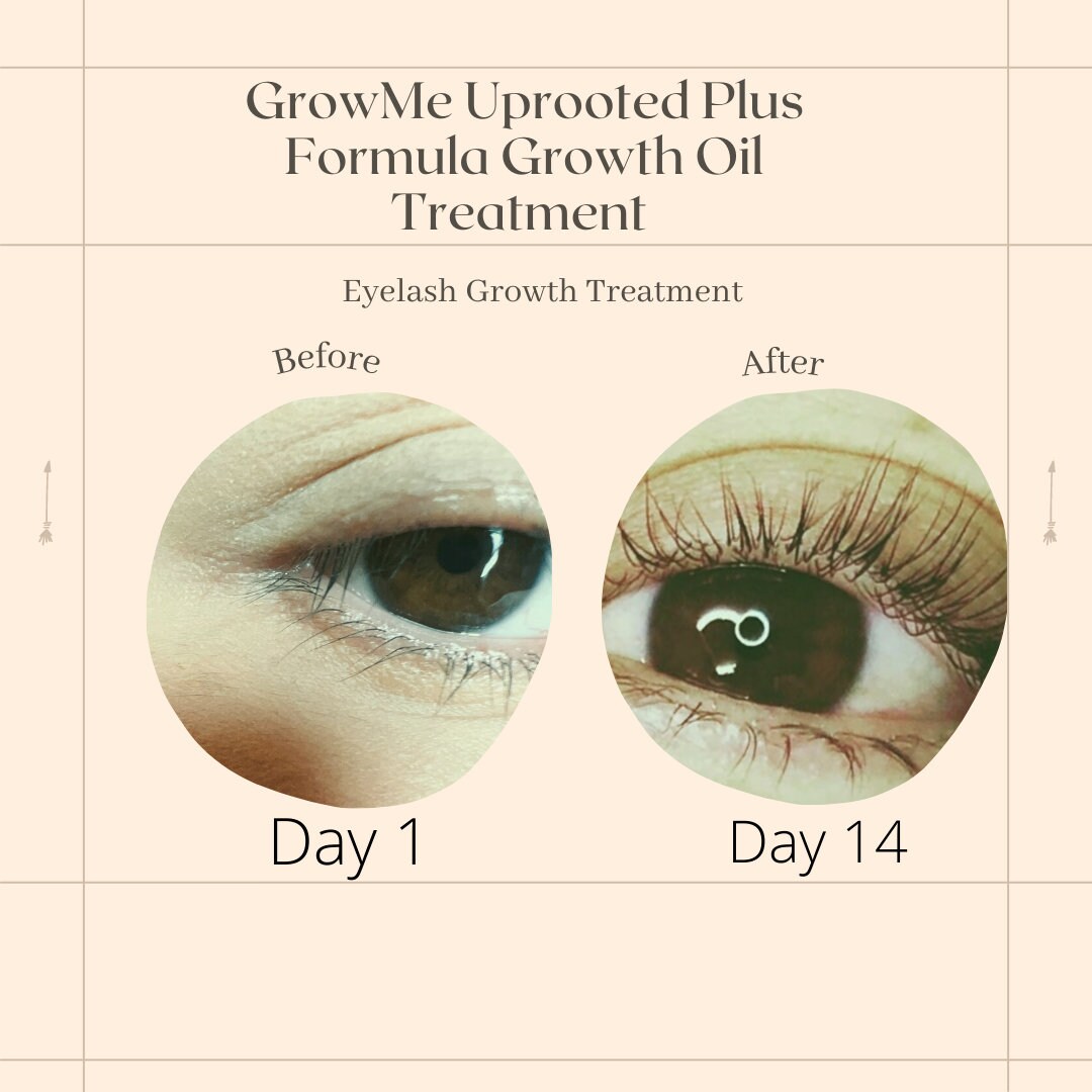Growme Uprooted Plus Formula Eyelash Growth Oil Treatment trichotillomania Pulling Disorders