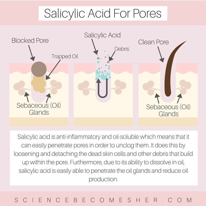 Salicylic Acid for Pores Template Etsy Norway Salicylic Acid for Pores Template Etsy Norway