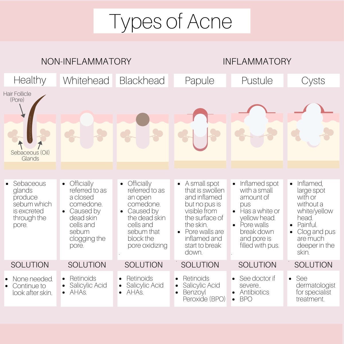 Types of Acne Diagram Etsy