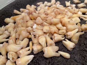 5 Real Human Teeth Molars, Premolars, & Anteriors