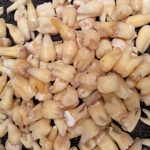 10 Real Human Teeth (Molars, Premolars, & Anteriors)