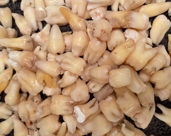 10 Real Human Teeth (Molars, Premolars, & Anteriors)