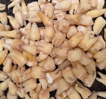 10 Real Human Teeth (Molars, Premolars, & Anteriors)
