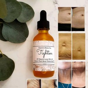 All Natural Loose Skin Tightening Skin Firming Moisturizing Oil | Stretch Marks | Firming | Dry Brushing | All Natural Body Care Product